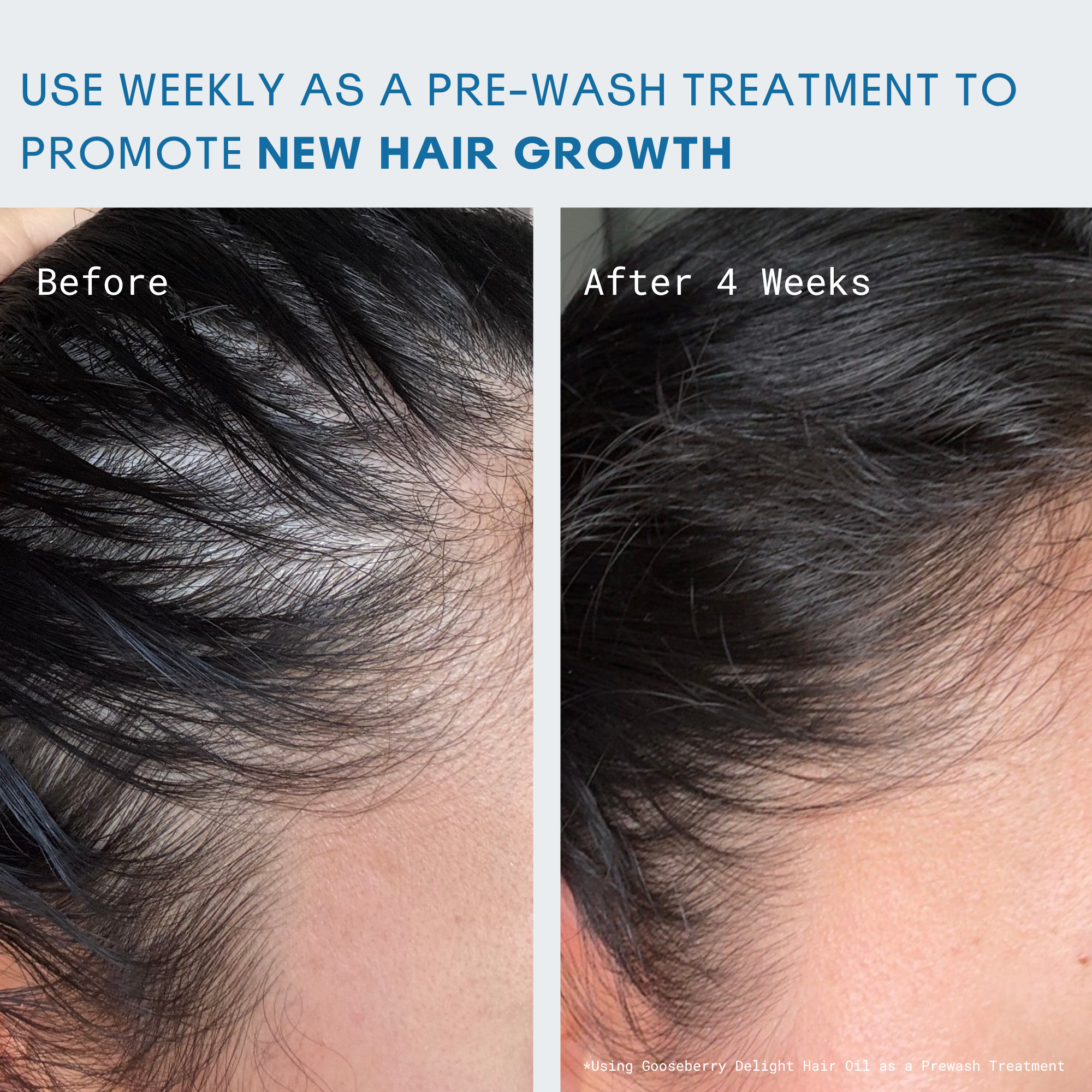 Gooseberry Delight® Hair Oil